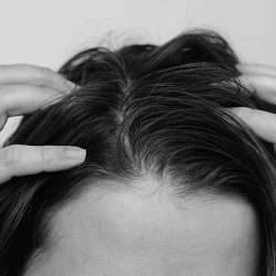 Cropped shot of a young woman with dirty greasy hair on a white background. The problem of oily scalp. Itching of the skin from long non-washes of the head